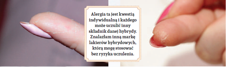 hipoalergiczni-alergia-to-nie-przelewki-Monika-Dobrzynska2